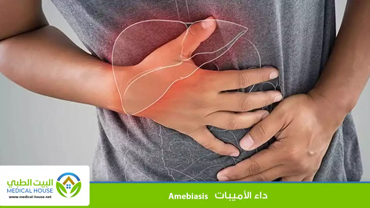 داء الأميبات (Amebiasis)