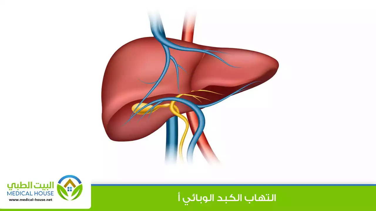 التهاب الكبد أ - Hepatitis A