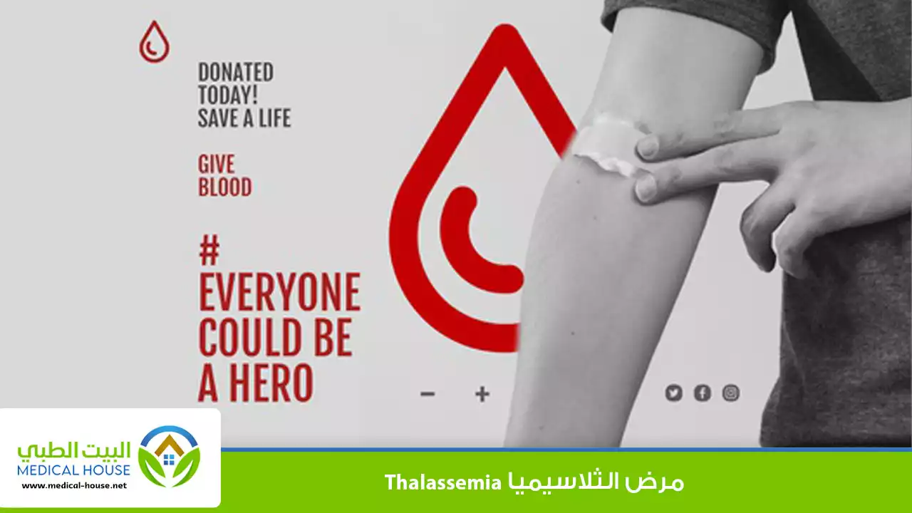 الثلاسيميا (Thalassemia)