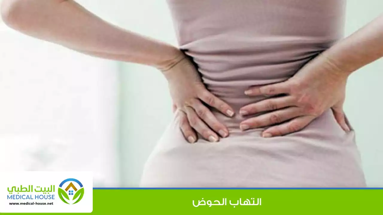 التهاب الحوض