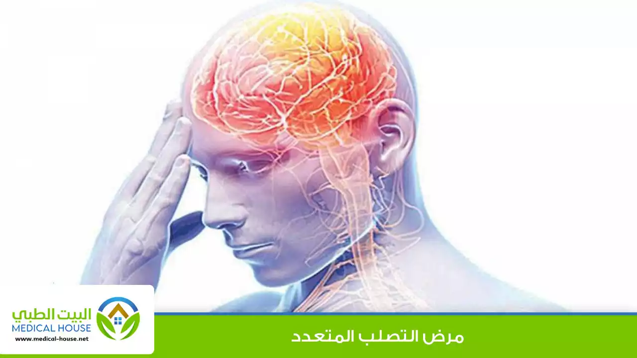 التصلب المتعدد Multiple sclerosis