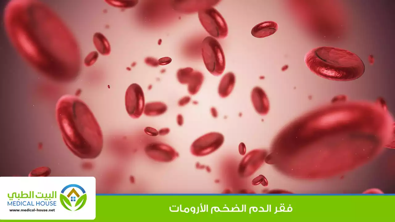فقر الدم الضخم الأرومات