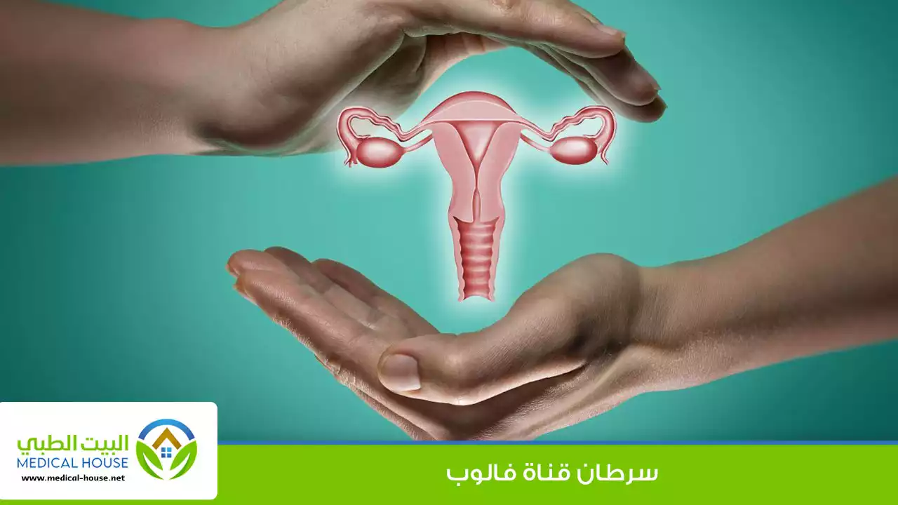 سرطان قناة فالوب