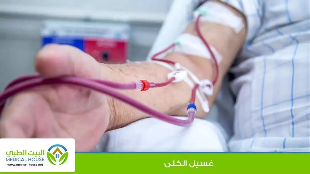 الغسيل الكلوي