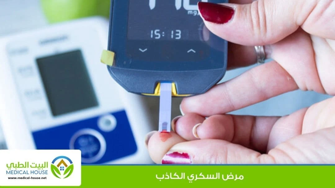مرض السكري الكاذب