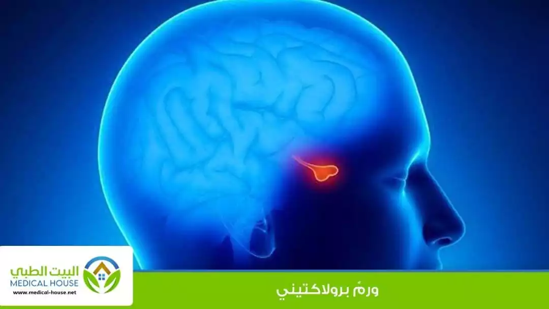 ورمٌ برولاكتيني