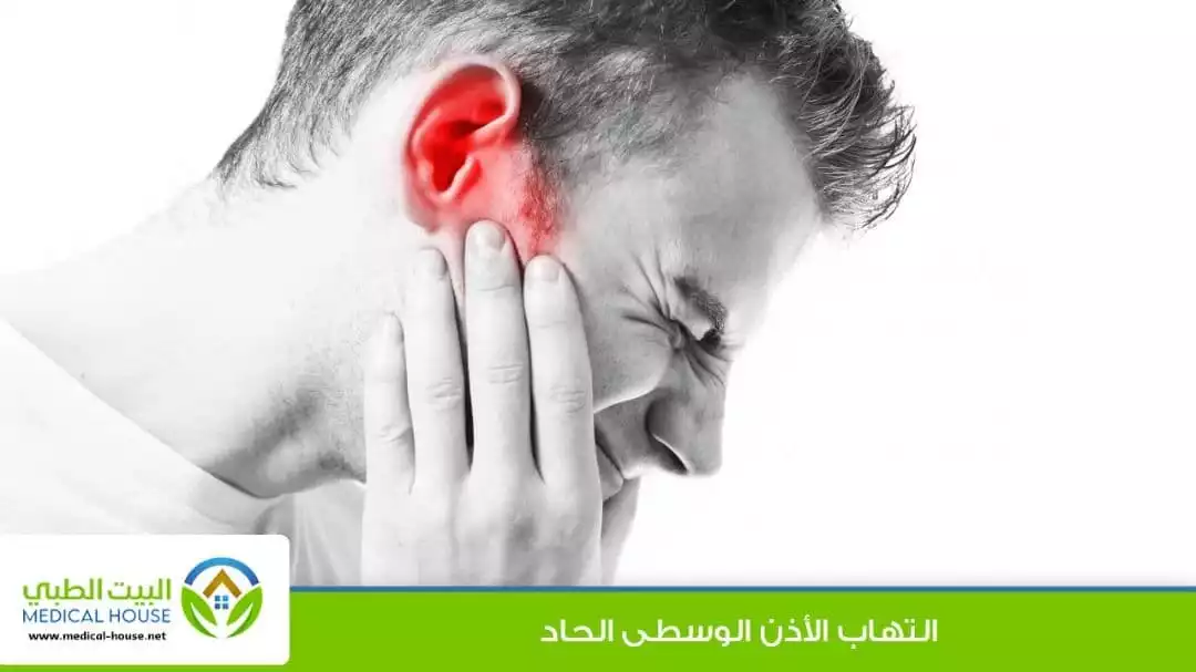 التهاب الأذن الوسطى