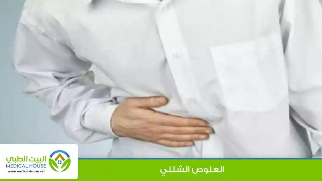 العلوص الشللي