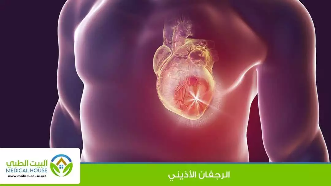 الرجفان الأذيني
