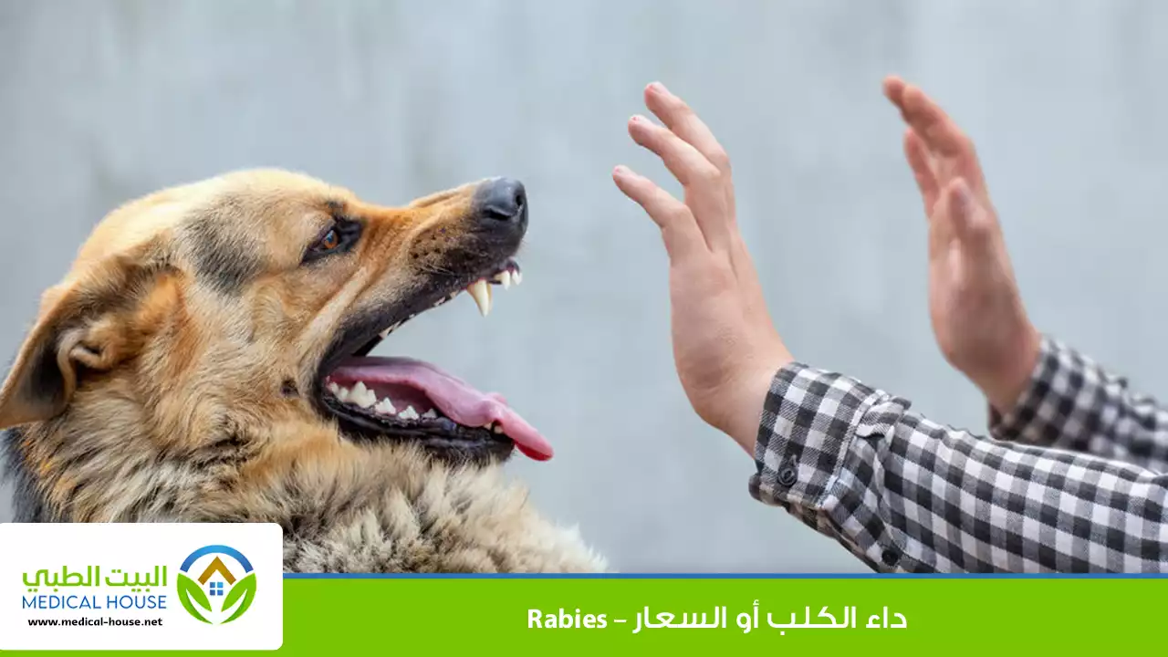 داء الكلب أو السعار