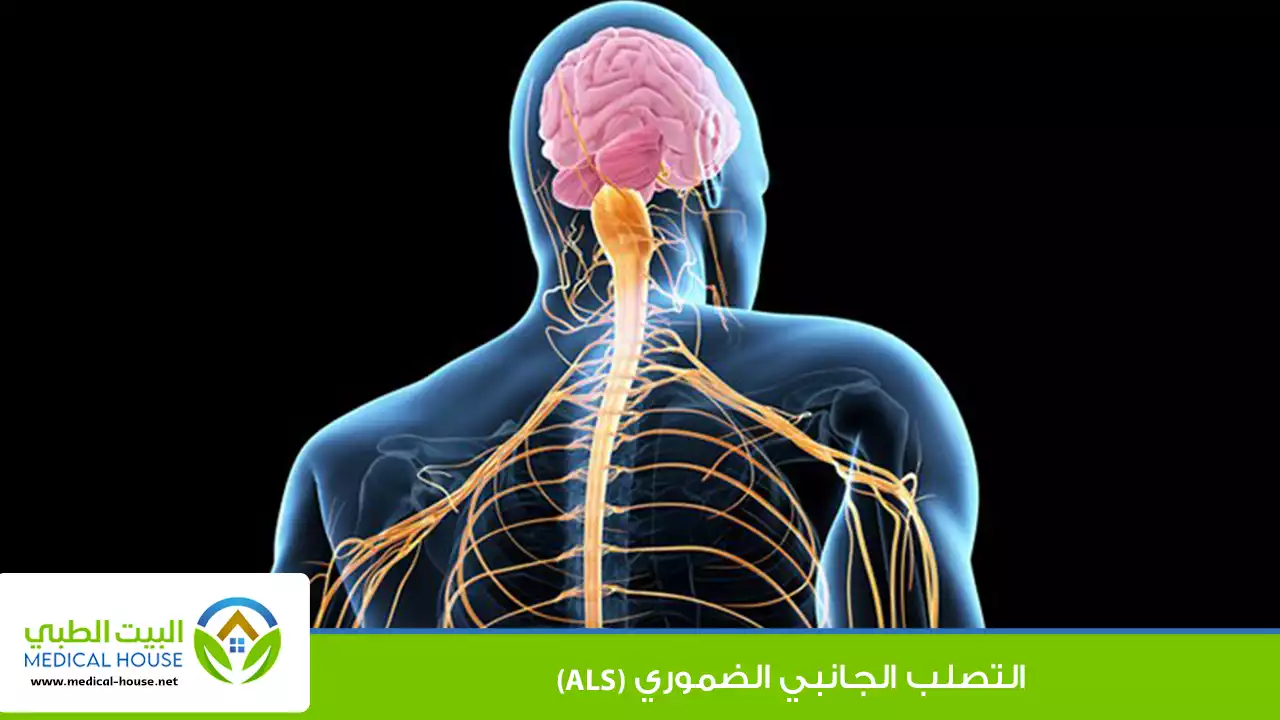 التصلب الجانبي الضموري