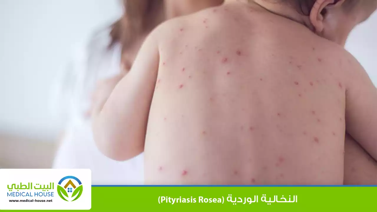 النخالية الوردية