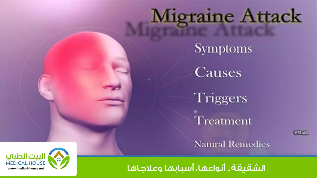 الشقيقة (الصداع النصفي ) Migraine