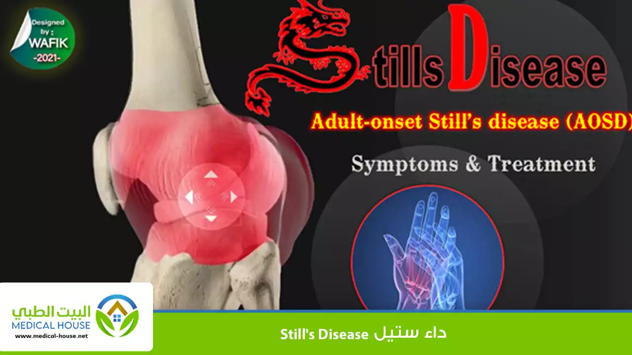 داء ستيل