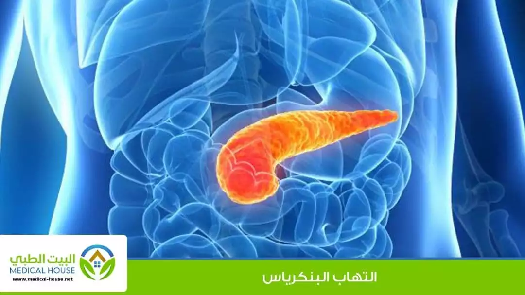 التهاب البنكرياس