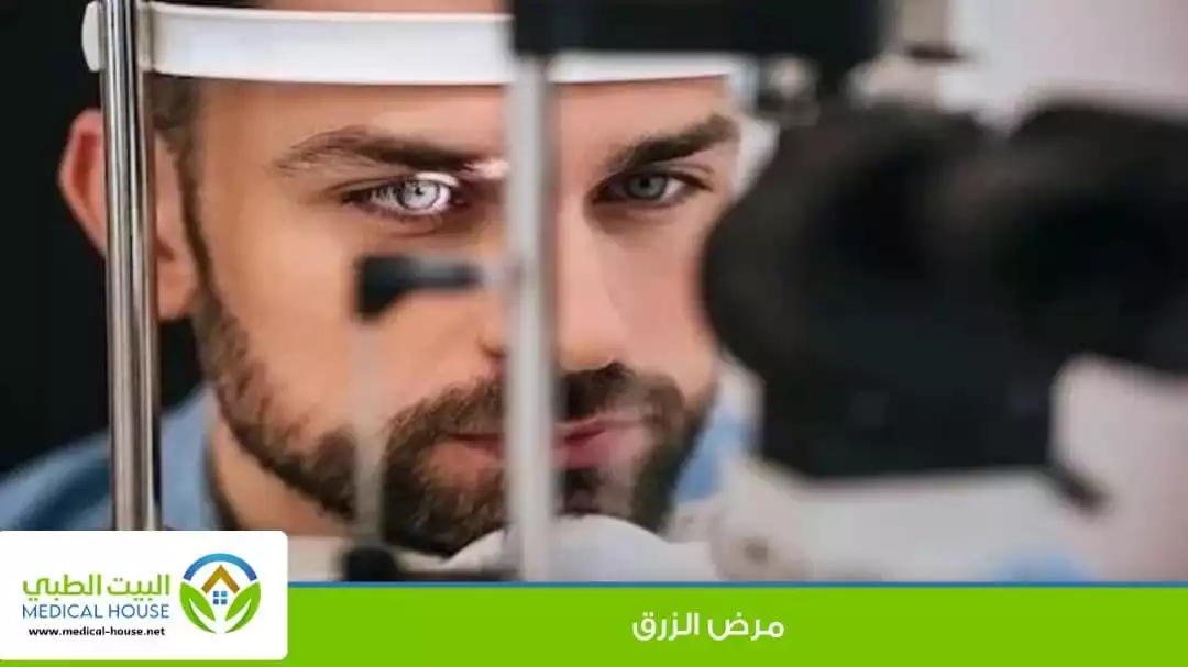 ماذا تعرف عن مرض الزرق