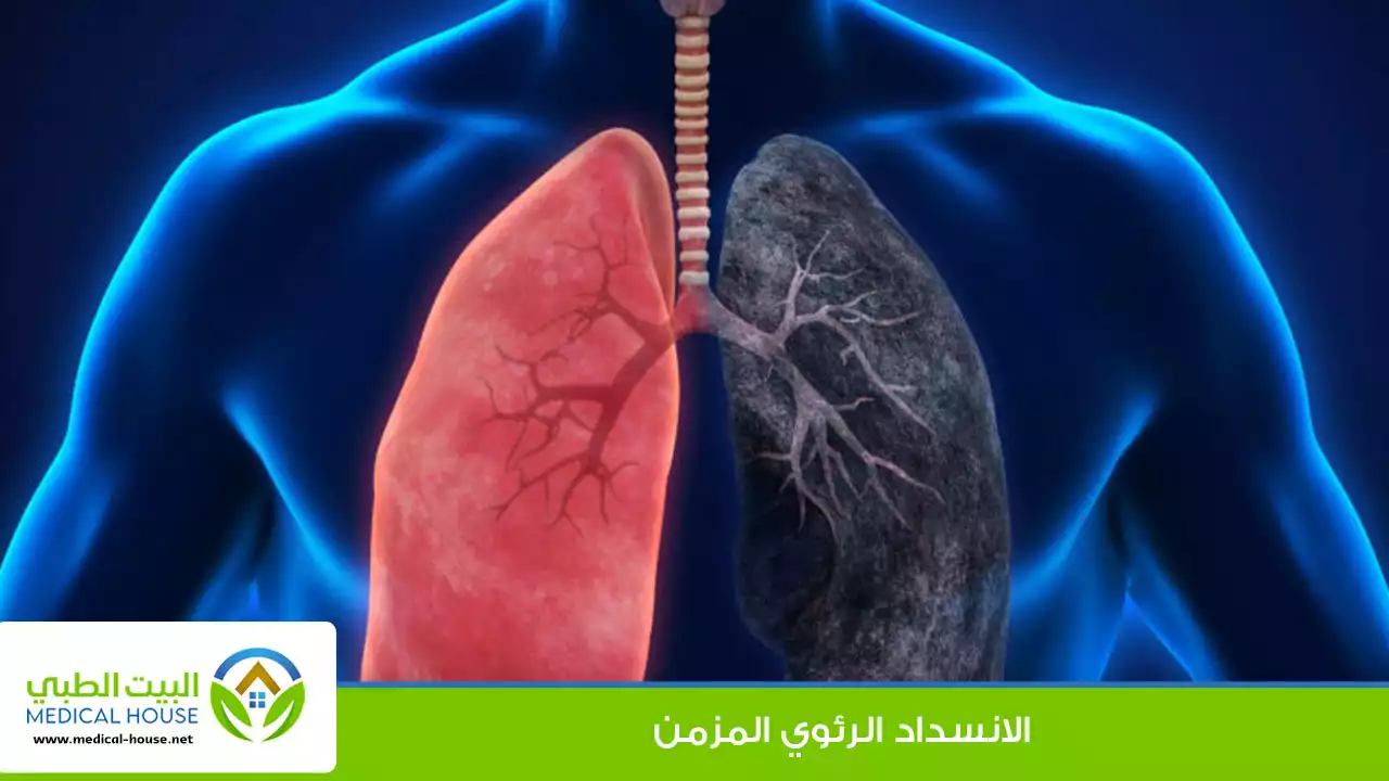 الانسداد الرئوي المزمن