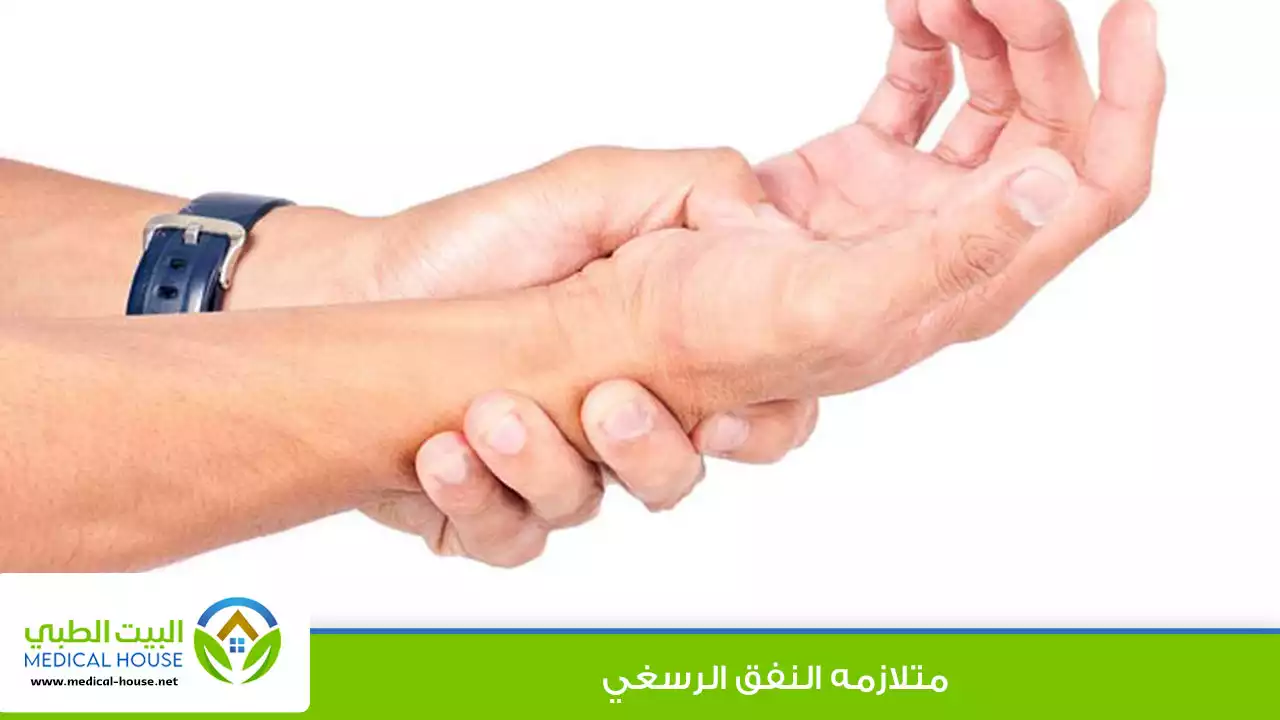 متلازمة النفق الرسغي