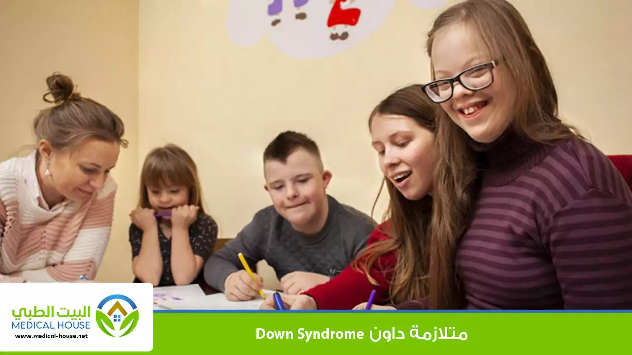 متلازمة داون