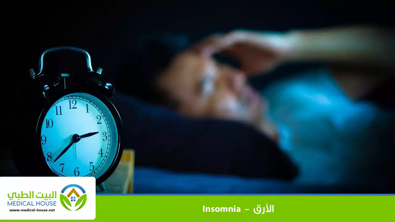 الأرق