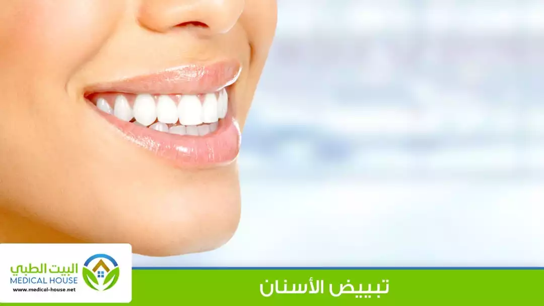 احدث طرق تبييض الأسنان