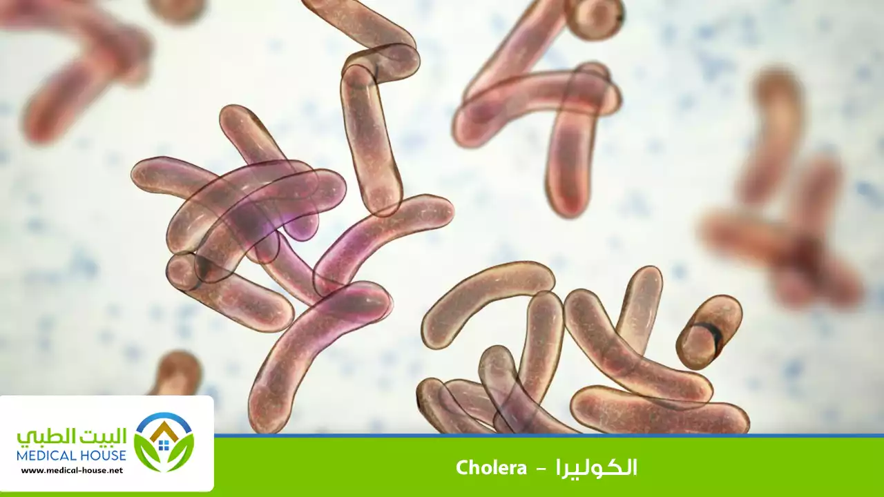 الكوليرا