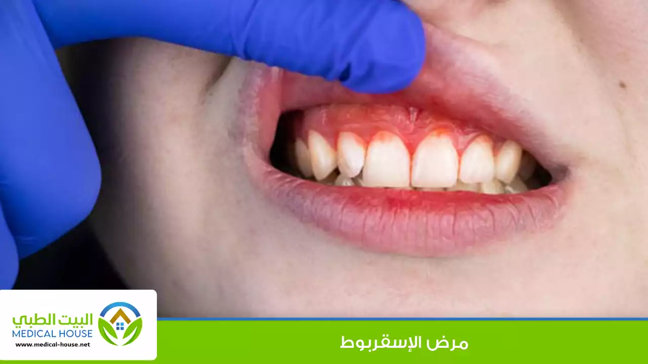 الإسقربوط