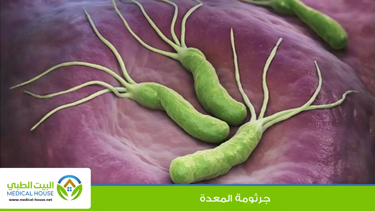 جرثومة المعدة