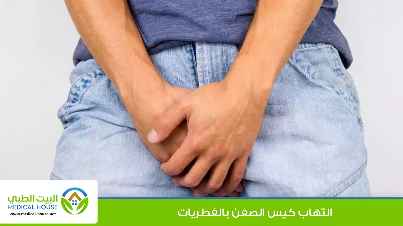التهاب كيس الصفن بالفطريات