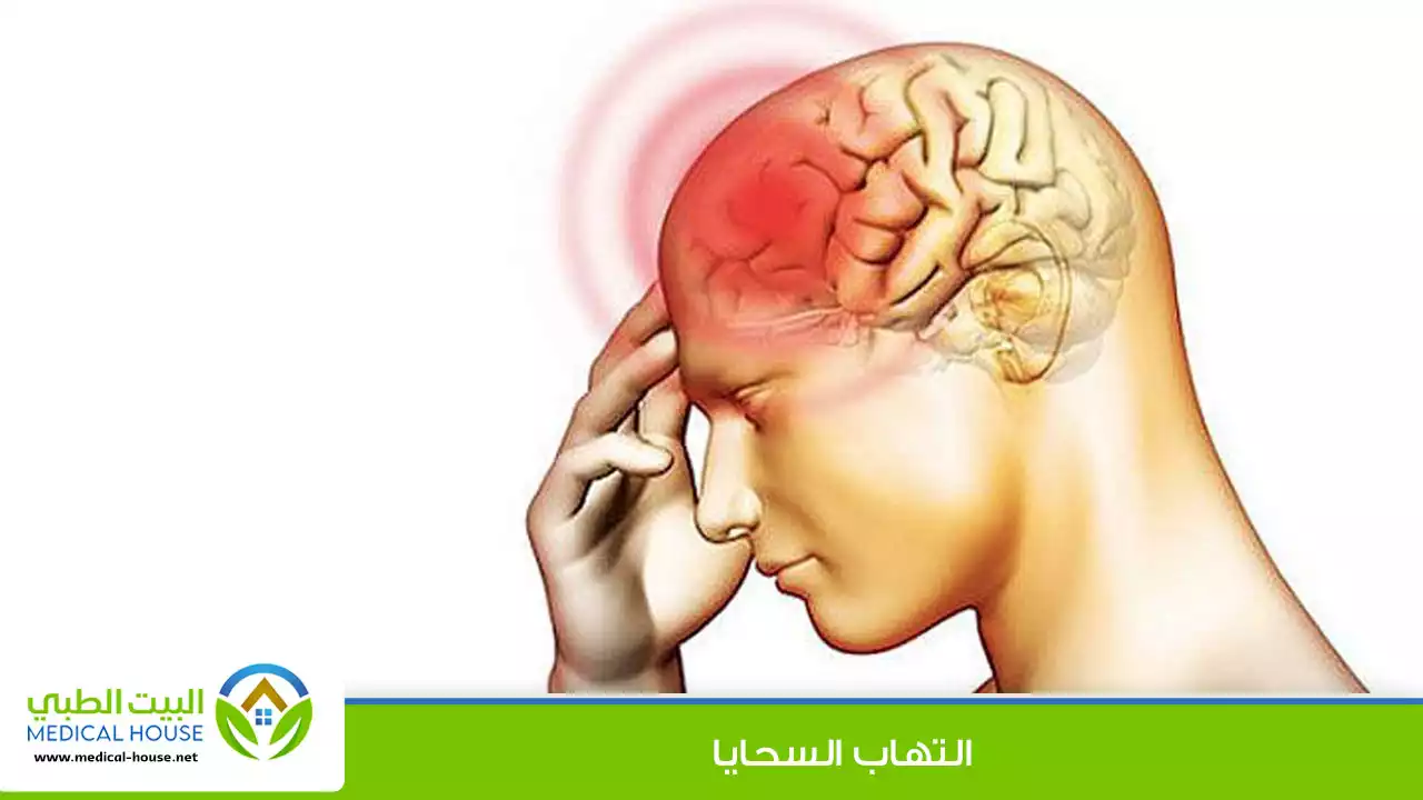 التهاب السحايا