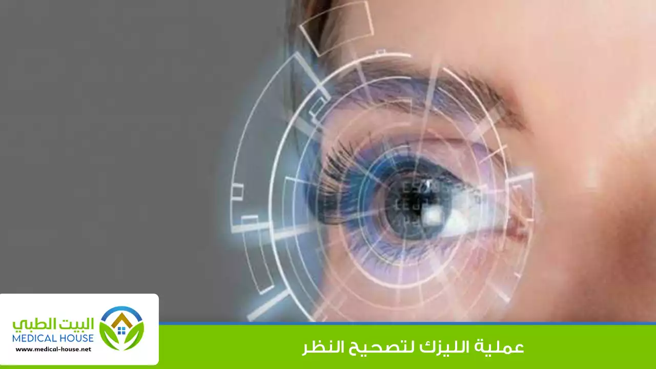 عملية الليزك لتصحيح النظر