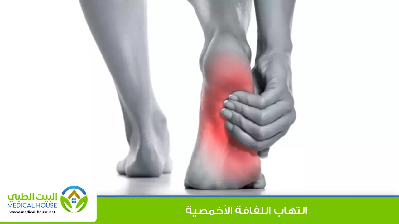 التهاب اللفافة الأخمصية