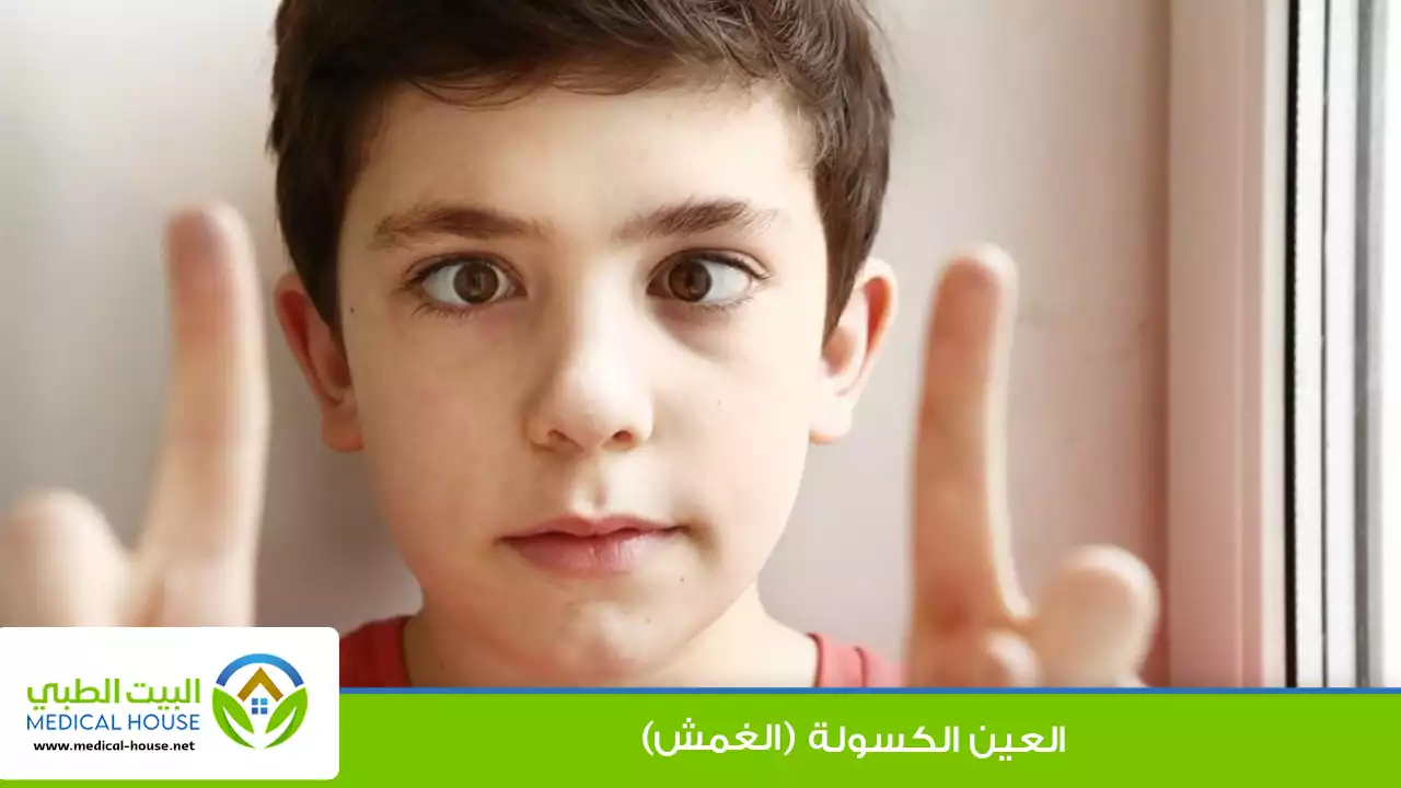 العين الكسولة (الغمش)