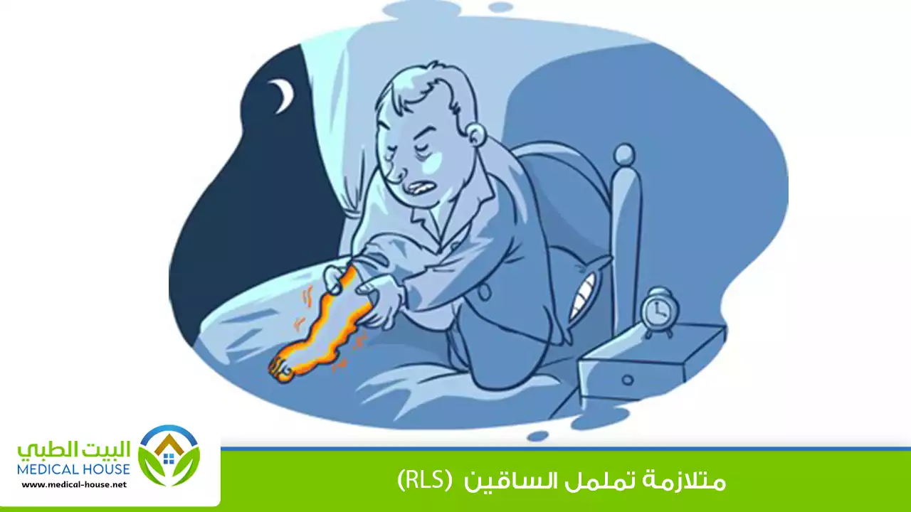 متلازمة تململ الساقين