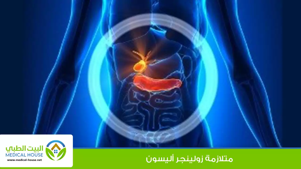 متلازمة زولينجر إليسون