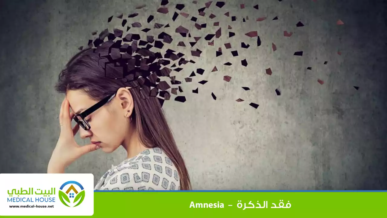 فقد الذاكرة
