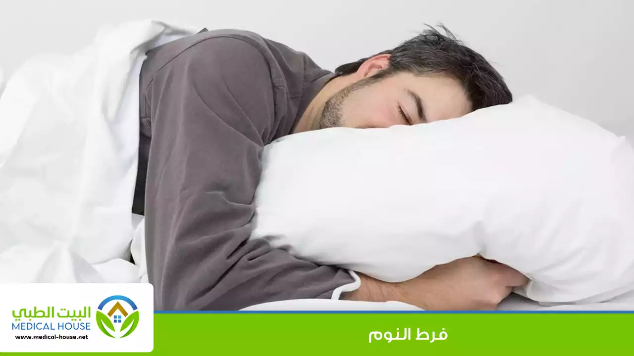 فرط النوم