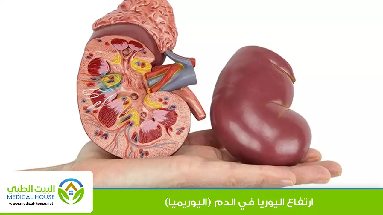 ارتفاع اليوريا في الدم