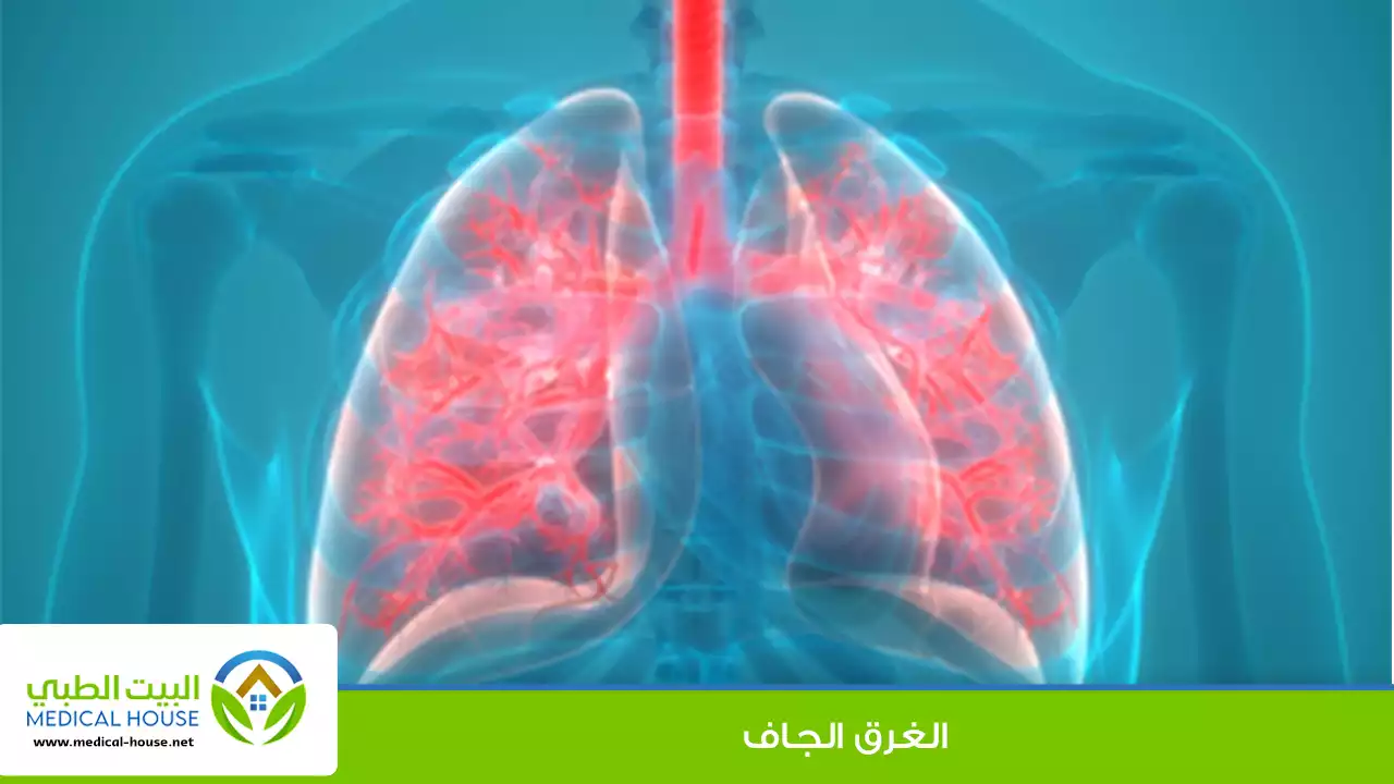 الغرق الجاف