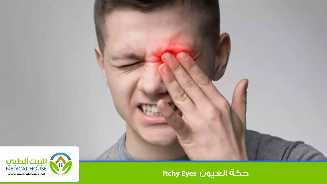 حكة العيون