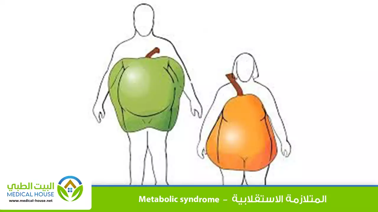المتلازمة الإستقلابية