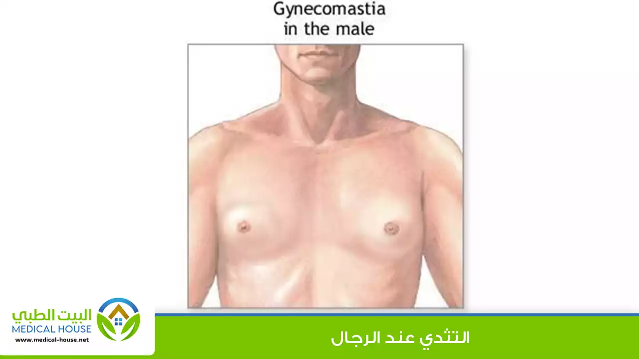 التثدي