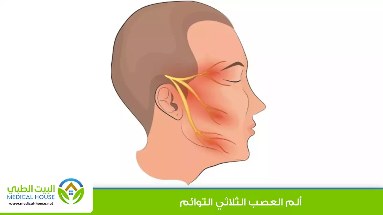 ماذا تعرف عن العصب الثلاثي التوائم؟