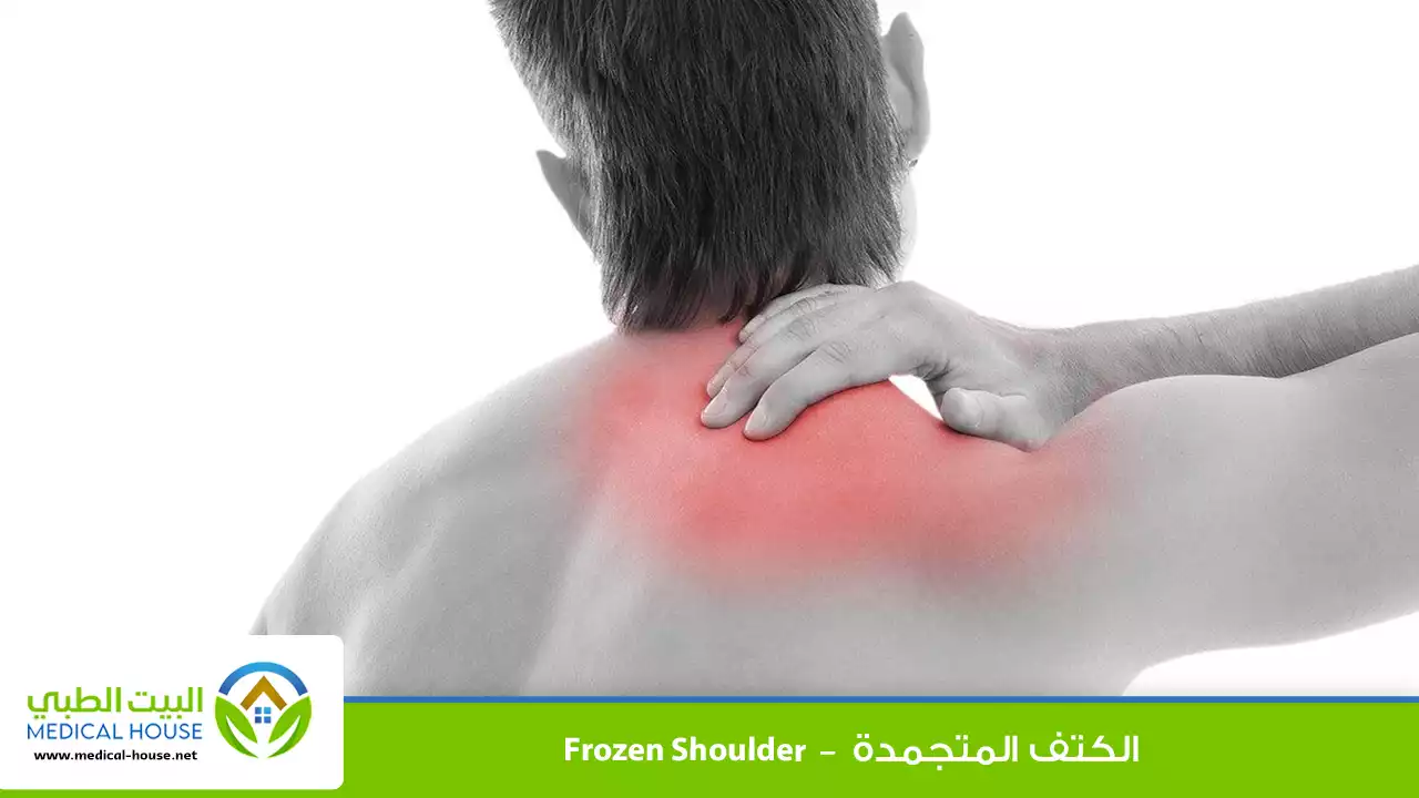 الكتف المتجمدة