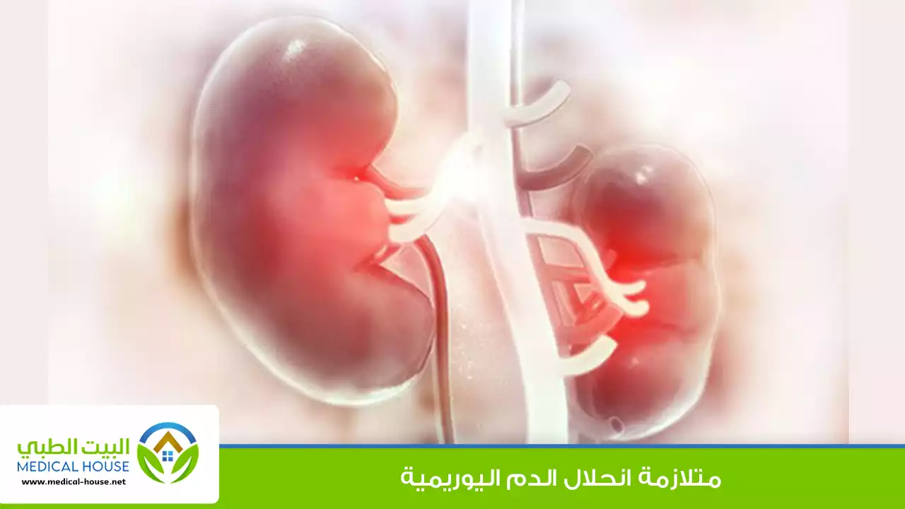 متلازمة انحلال الدم اليوريمية