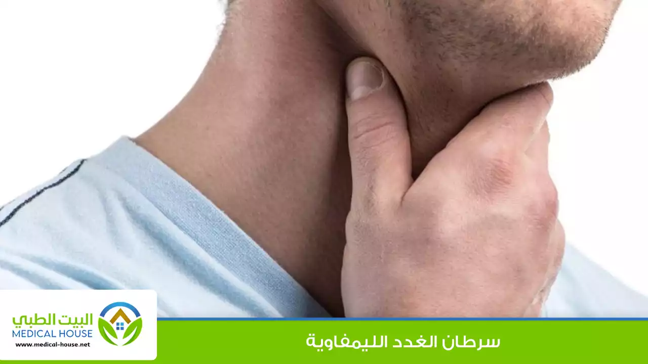سرطان الغدد الليمفاوية (اللمفوما)