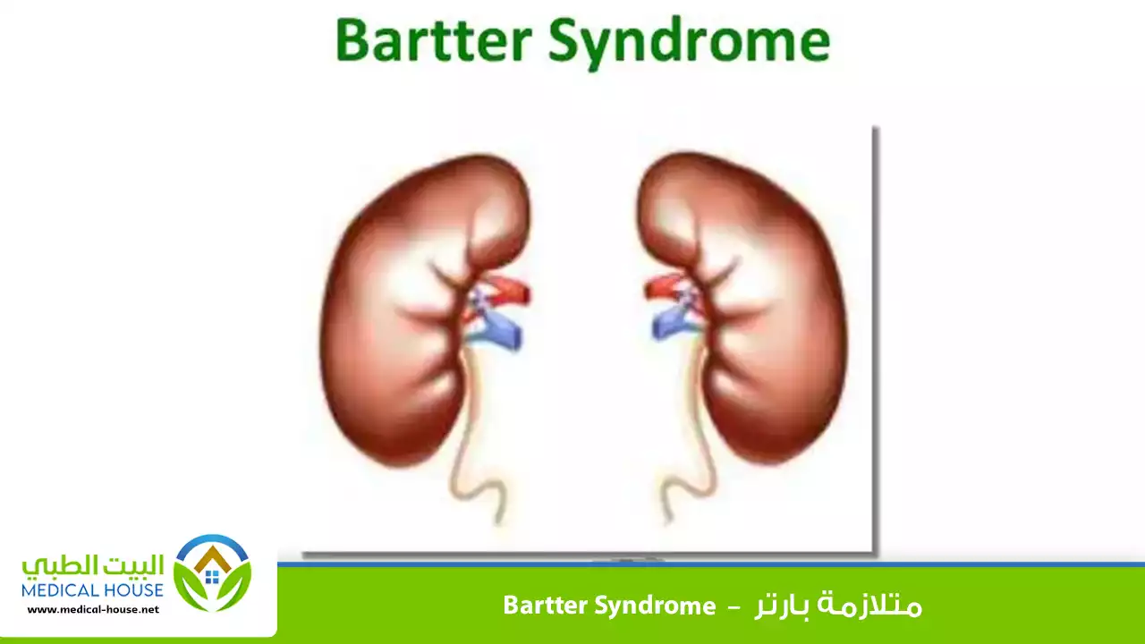 متلازمة بارتر