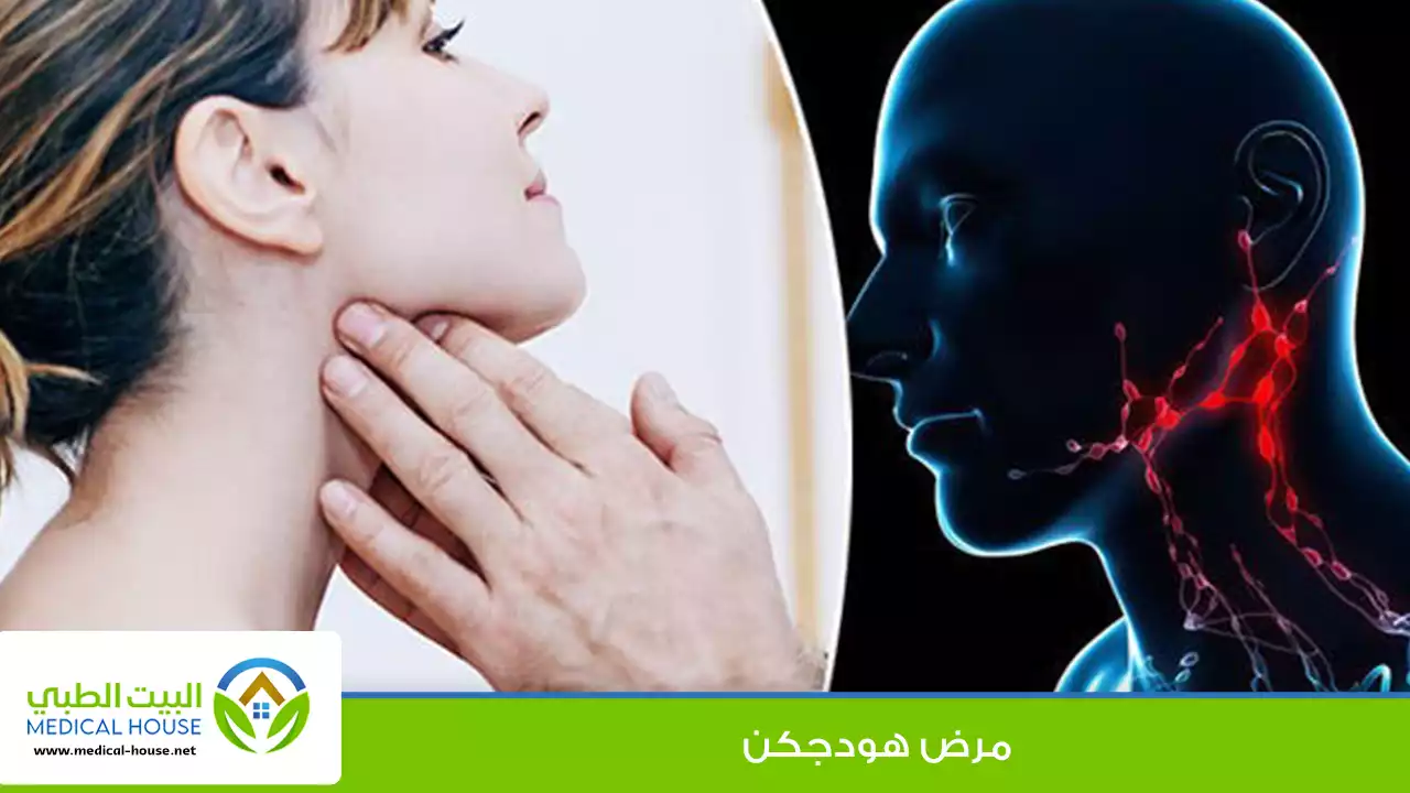 مرض هودجكن