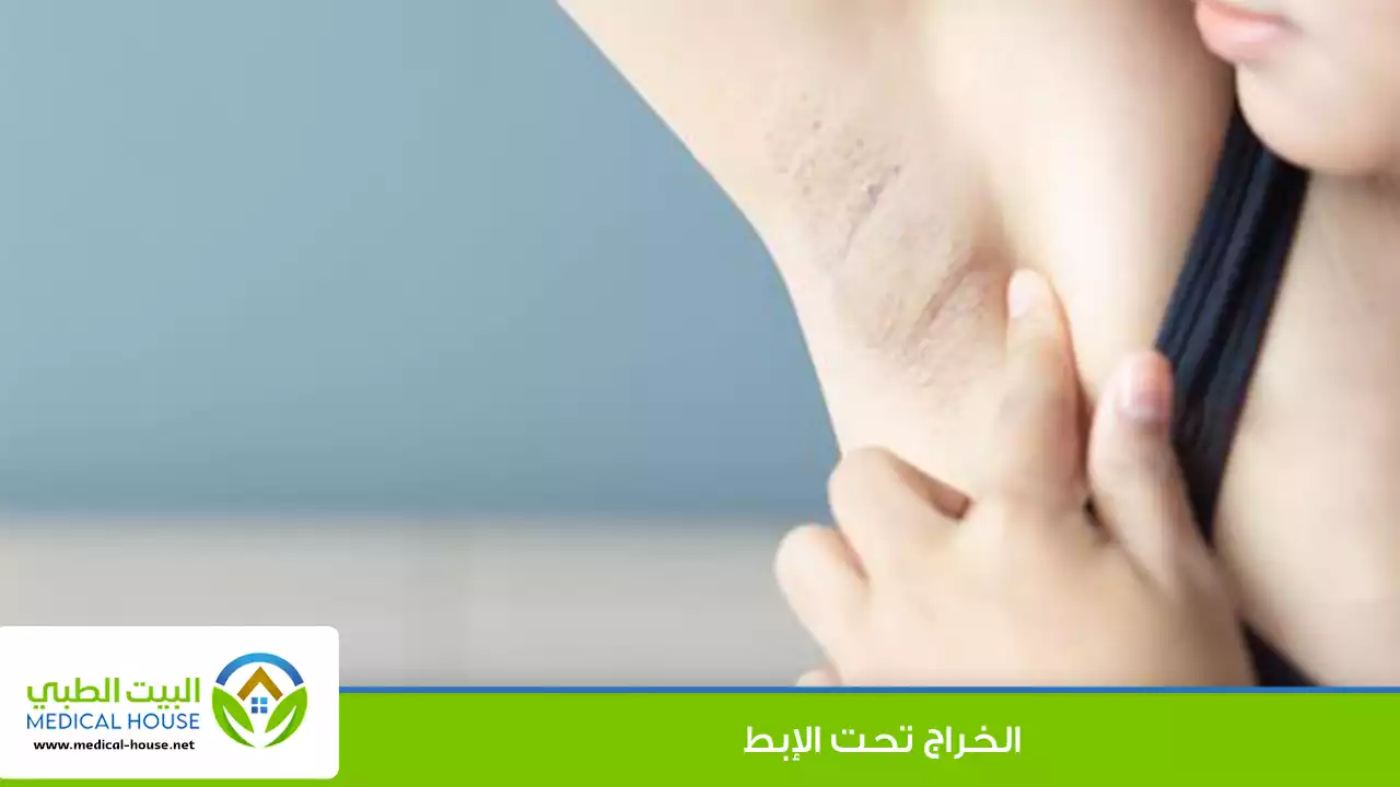 الخراج تحت الإبط