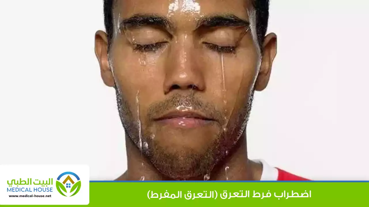 اضطراب فرط التعرق